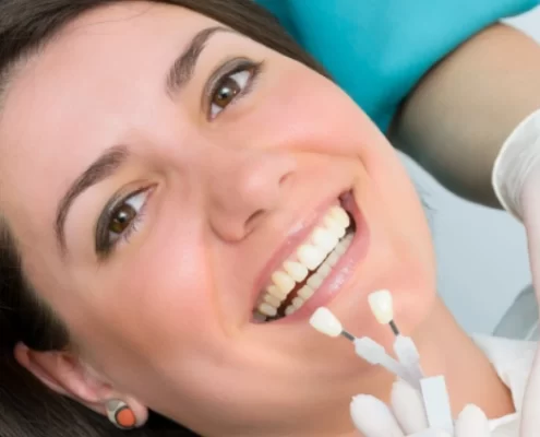 How Much Do Dental Veneers Cost