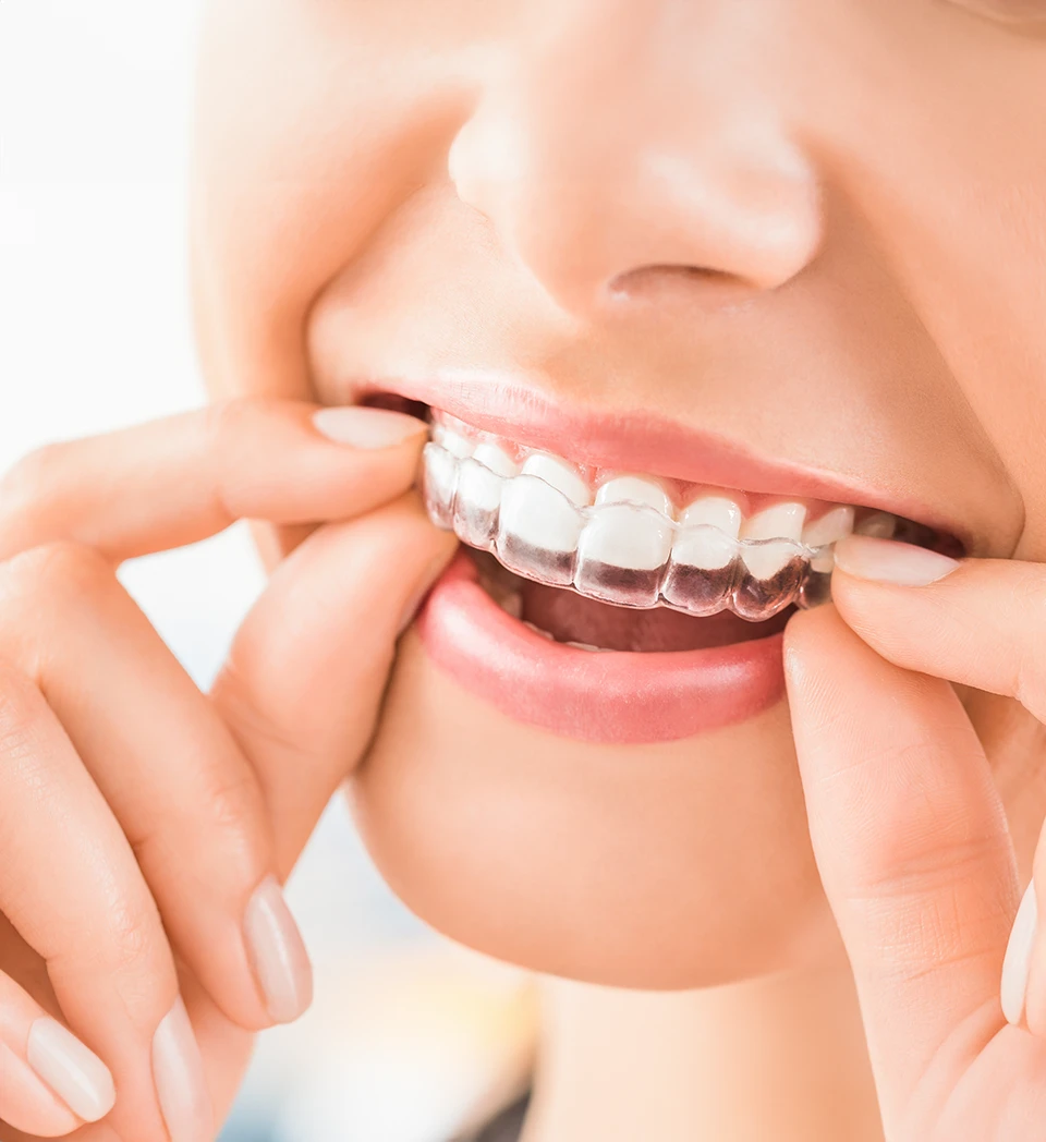 caring for your invisalign aligners